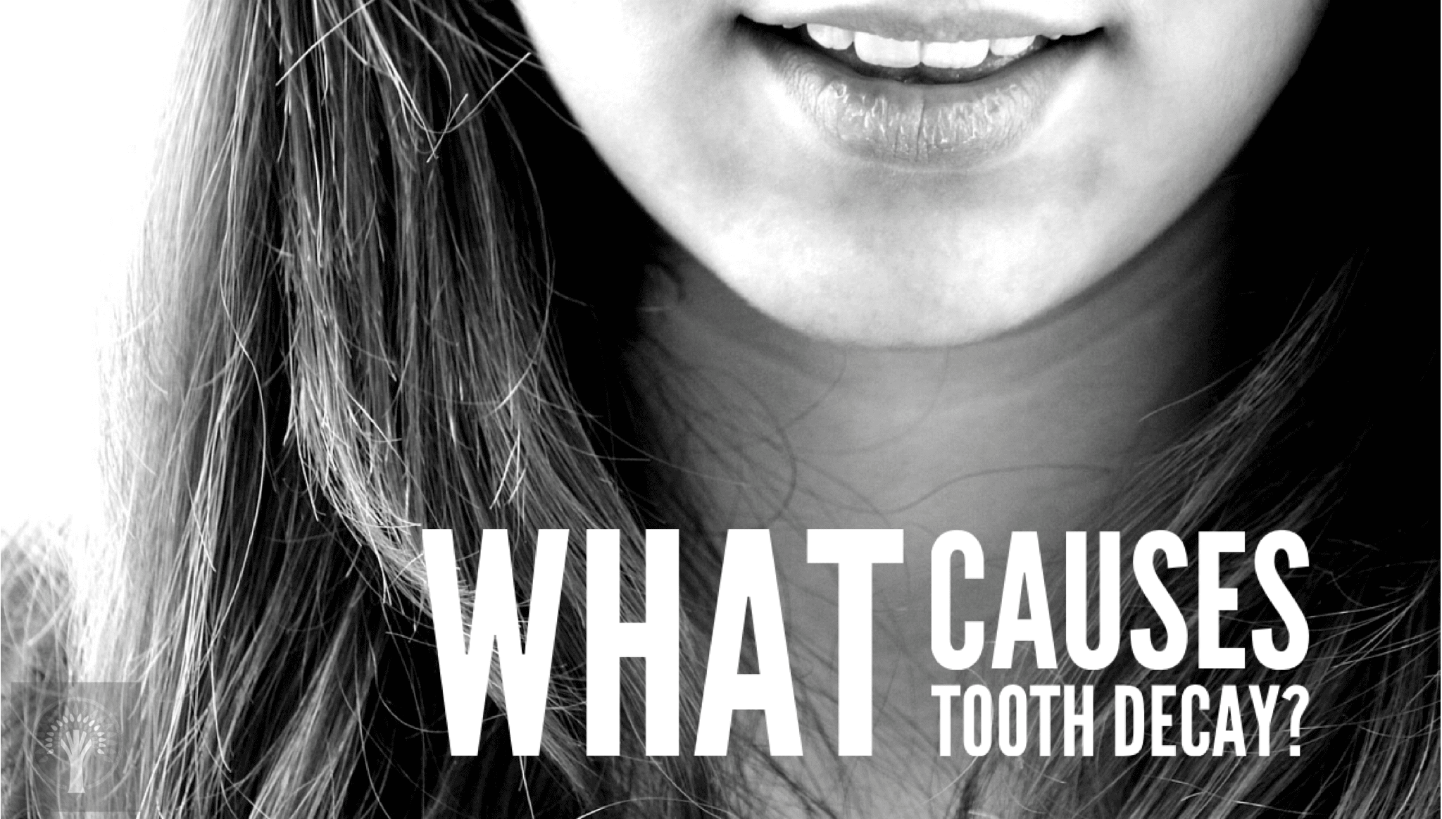 What Causes Tooth Decay?