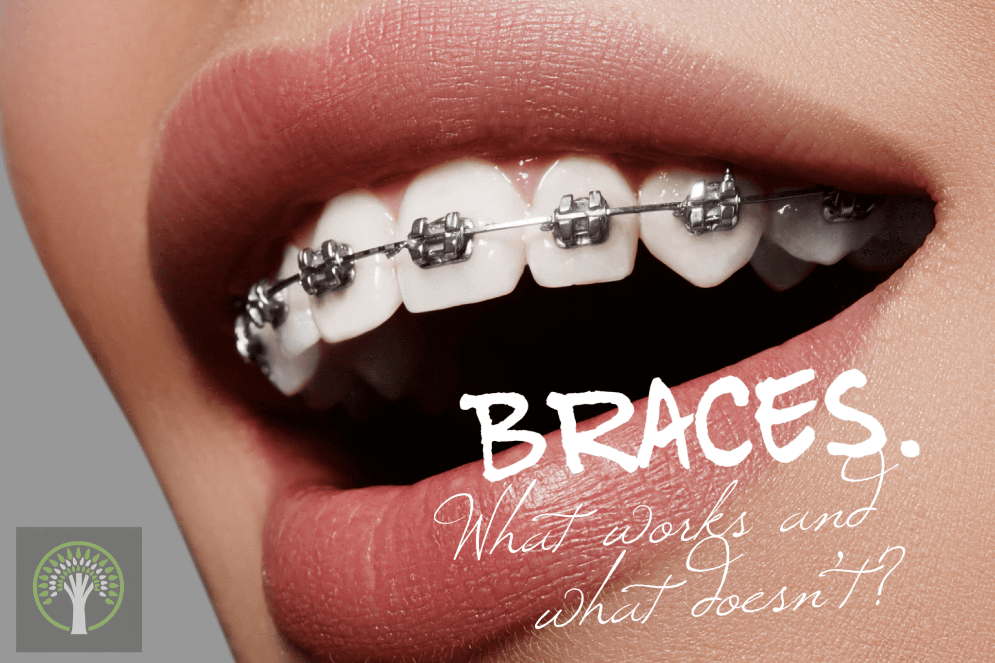 Braces. What Works and What Doesn’t?