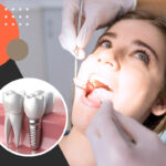 Top Tips and Tricks to Take Care of Dental Implants