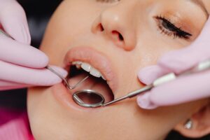 Smile-makeover-in-bradford_Eccleshill-Dental