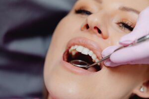 Smile makeover in bradford_Eccleshill Dental2