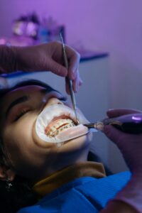 Real Stories of Teeth Straightening in Bradford11
