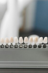 Do Dental Crowns Look Natural22