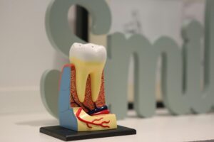 Choosing the Right Root Canal Specialist in Bradford22