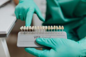 Affordable Dental Veneers in Bradford