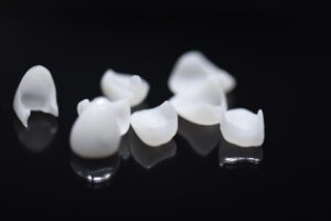 Affordable Dental Veneers in Bradford 34
