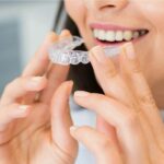 Invisalign braces in Bradford used to straighten teeth discreetly