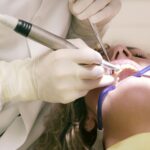 Signs you need a root canal