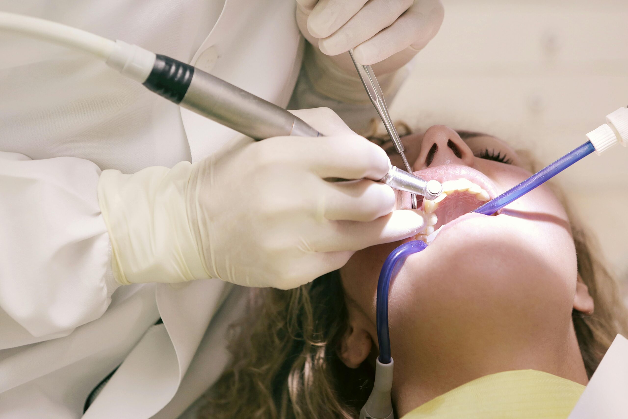 Signs you need a root canal - Eccleshill Dental Bradford